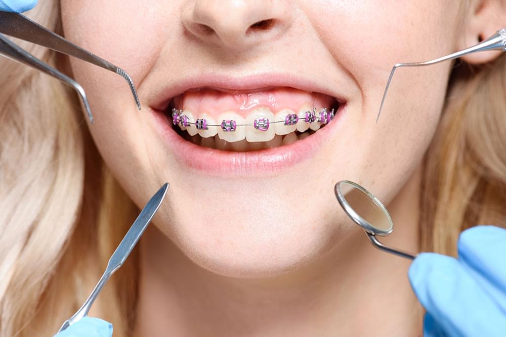 Orthodontist Leads #5 - damianmartinez.com